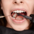 Getting a Second Opinion from a Dentist in Chandler, Arizona