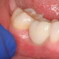 Does the Best Dentistry in Chandler, Arizona Offer Periodontal Services?