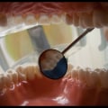 Does Arizona Medicaid Cover Dental for Adults?