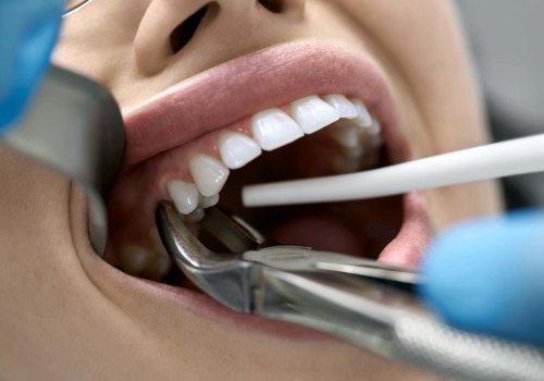 What Aftercare Instructions Are Provided After Treatments and Procedures at the Best Dentistry in Chandler, Arizona?