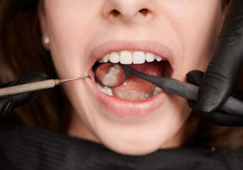 Getting a Second Opinion from a Dentist in Chandler, Arizona