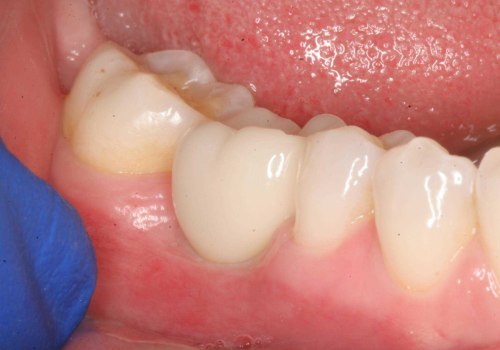 Does the Best Dentistry in Chandler, Arizona Offer Cosmetic Dentistry Services?