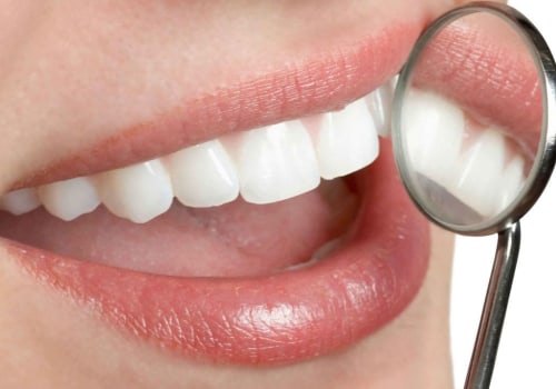 Does Professional Teeth Whitening with Zoom Give You a Brighter Smile in Chandler, Arizona?