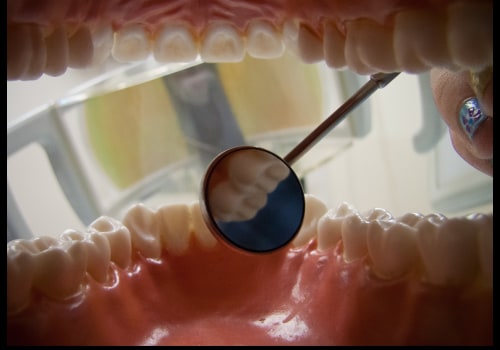 Does Arizona Medicaid Cover Dental for Adults?